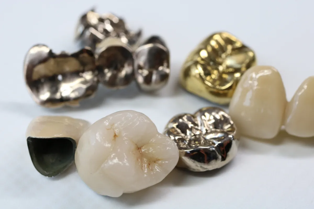 銀歯、金歯、白い歯